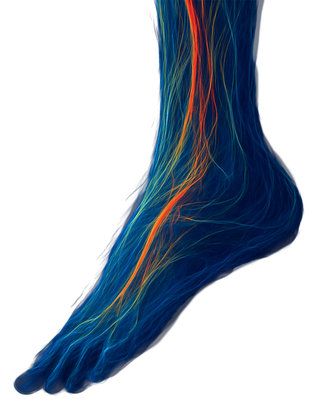 Advancing PAD Care and Beyond